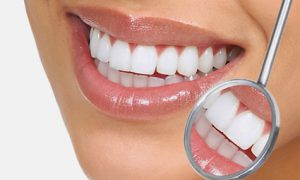 Dientes mal posicionados y Rotaciones Dientes mal posicionados y Rotaciones