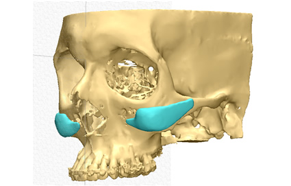 Diagnóstico y Planificación 3D en Argentina Diagnóstico y Planificación 3D en Argentina