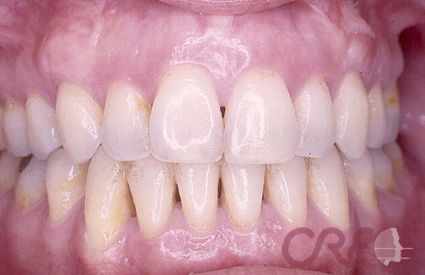 Periodoncia - Después Periodoncia - Después