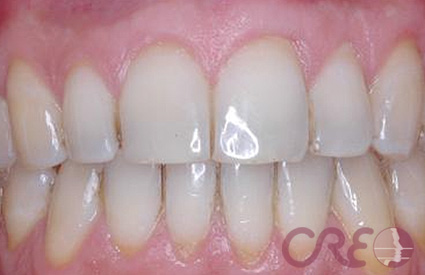 Periodoncia - Después Periodoncia - Después