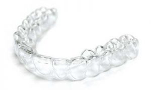 clear-aligner clear-aligner