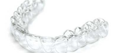 clear-aligner clear-aligner