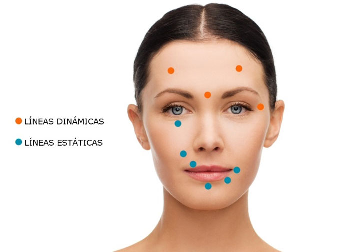 botox01