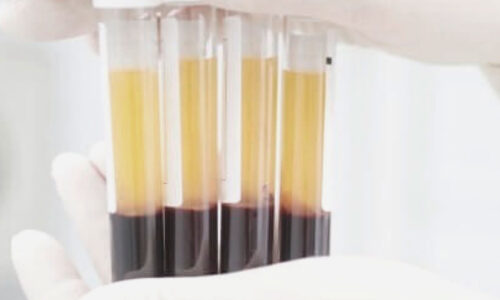 plasma plasma